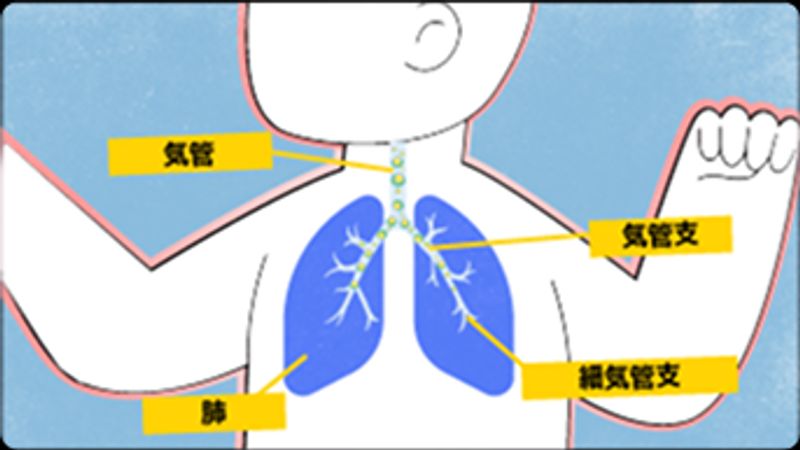 赤ちゃんの免疫システムが、RSウイルスの気道感染と戦う様子を示す画像