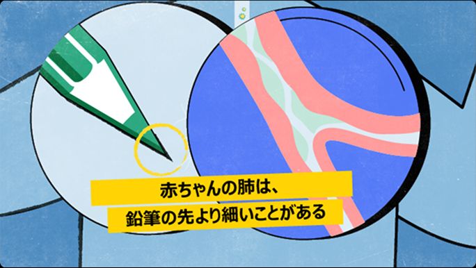 乳児の気道と鉛筆の先端の比較画像。鉛筆の方が太いことを示している