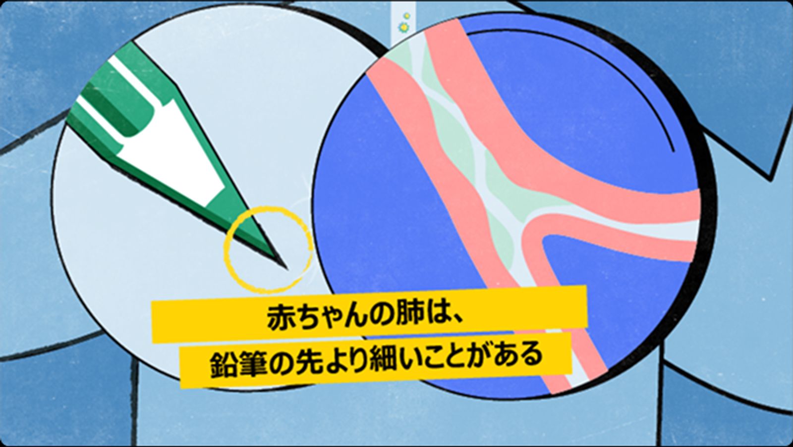 乳児の気道と鉛筆の先端の比較画像。鉛筆の方が太いことを示している