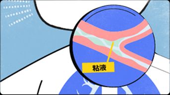 気道に粘液がたまり、赤ちゃんが咳をしている様子の画像