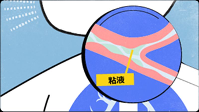 気道に粘液がたまり、赤ちゃんが咳をしている様子の画像